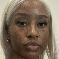 freckledn Nahé