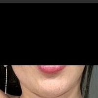 Melina Ithurrat Nahé