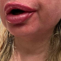 Nina NorthStar Nahé